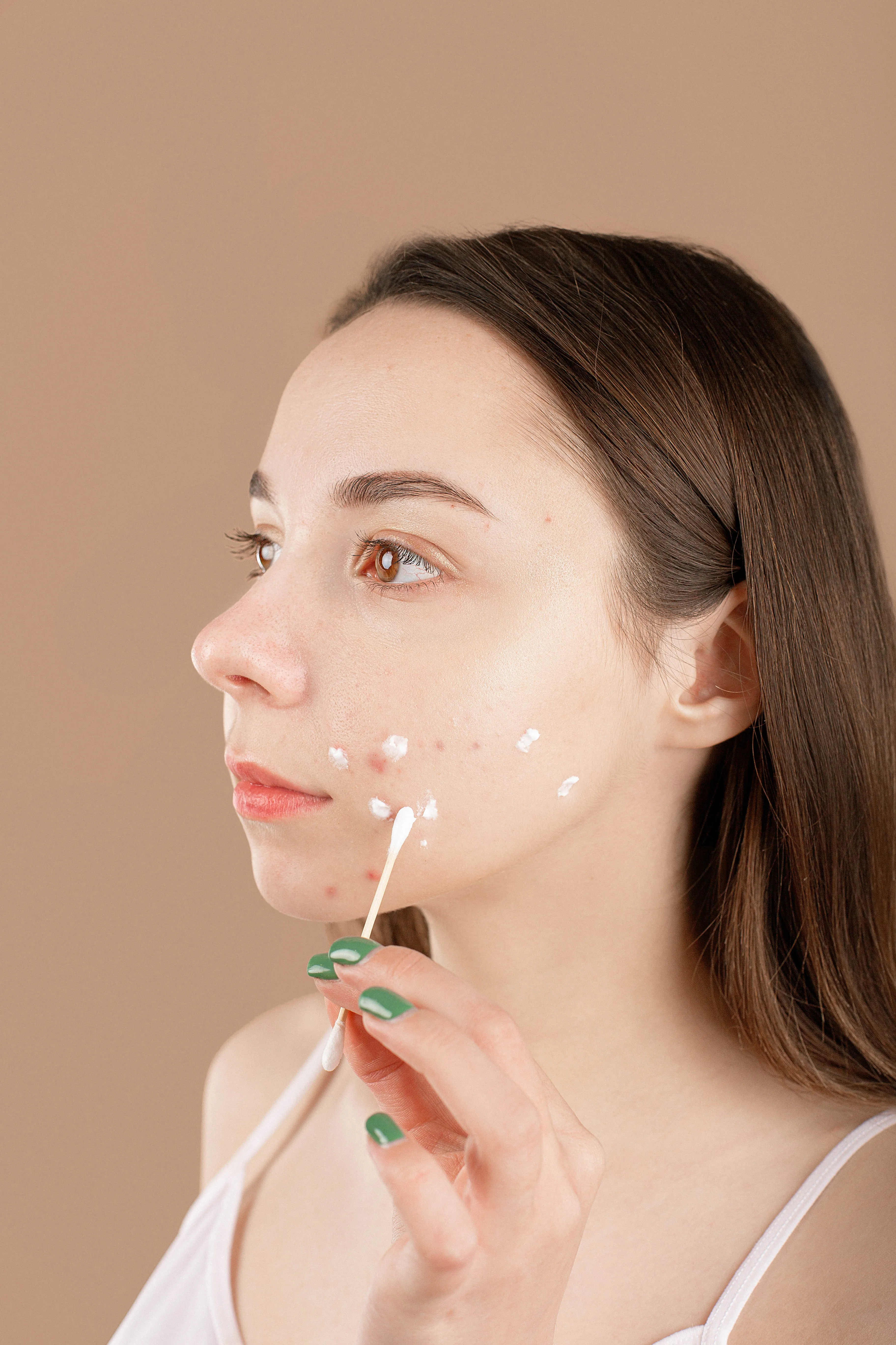 a woman applying medicine over pimples